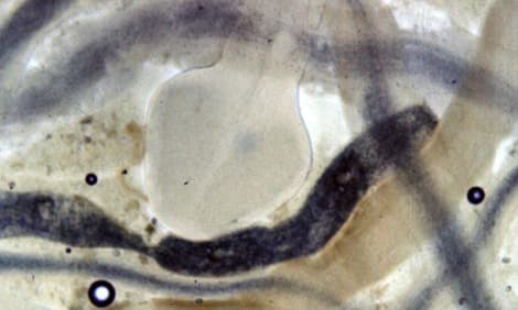 Tapeworms, Cestoda