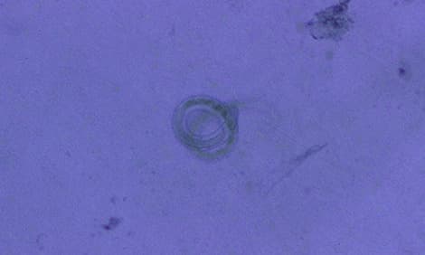 Nematodes, Capillaria, roundworms