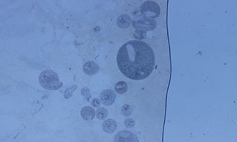 Boala petelor, Ichthyophthirius multifiliis, pete albe, gris sau boala petelor albe