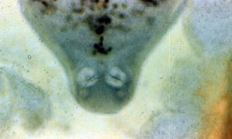 Flukes, trematodes, acanthocephales