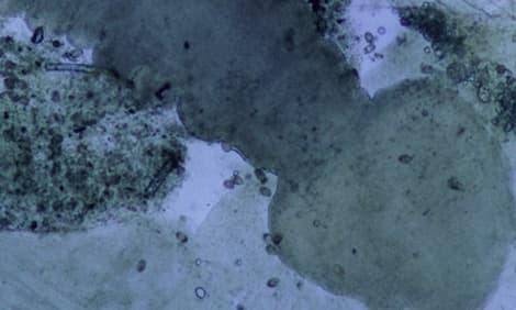 Tapeworms, Cestoda